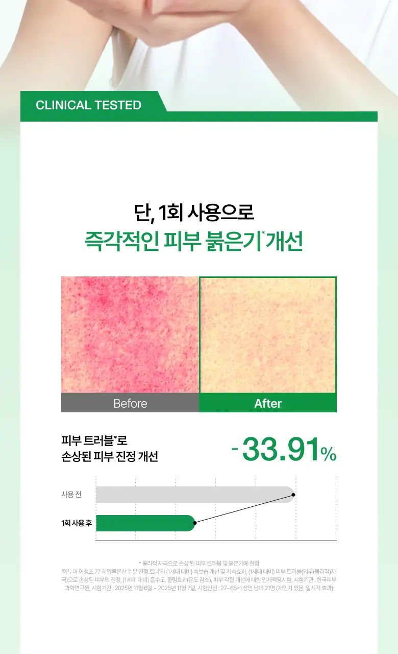 [NEW/리뉴얼] 아누아 어성초 77 히알루론산 수분 진정 토너 350ml 상세페이지 19